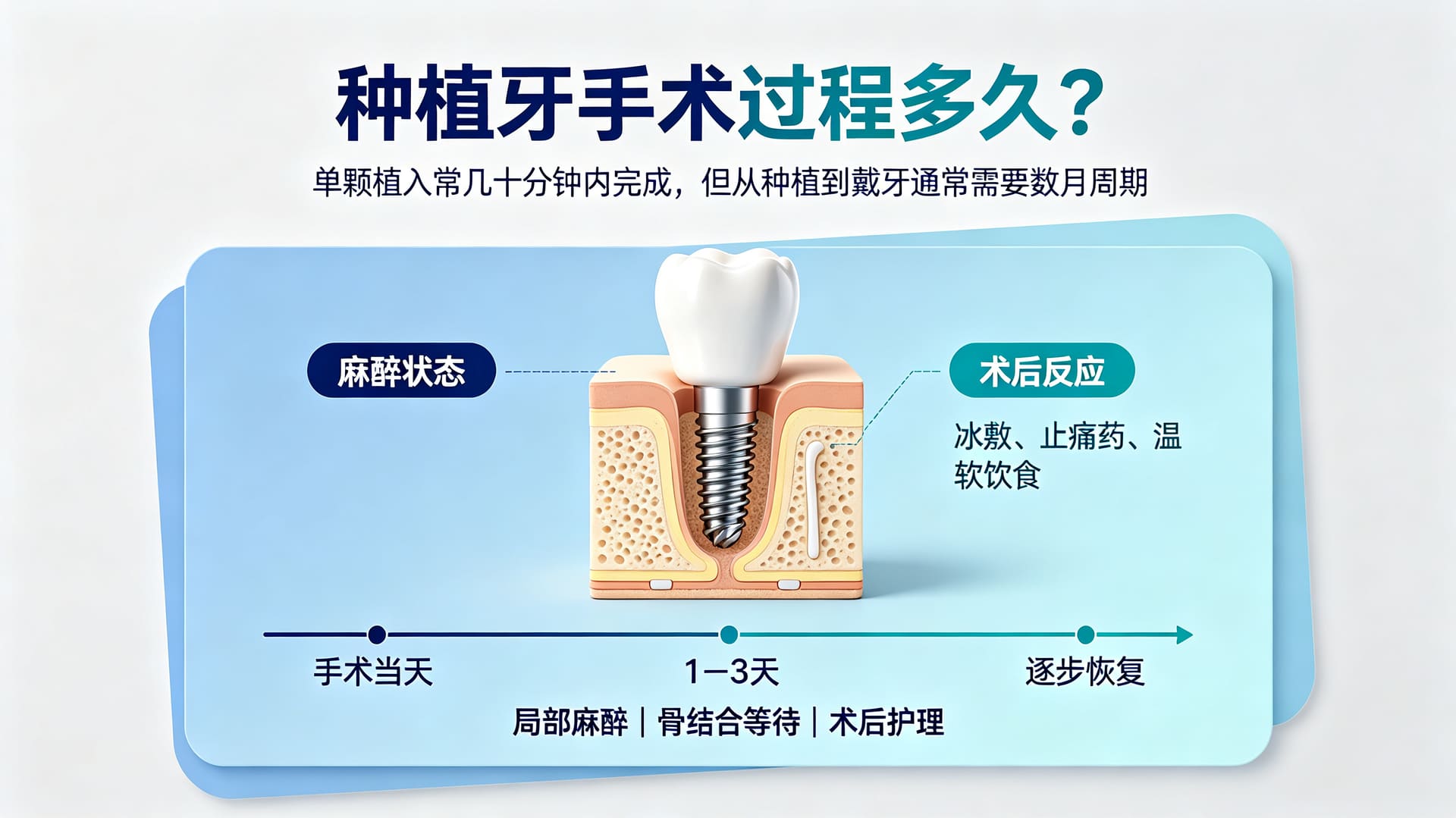 种牙疼不疼?种植牙手术过程多久、术后注意什么——海南微笑口腔医院