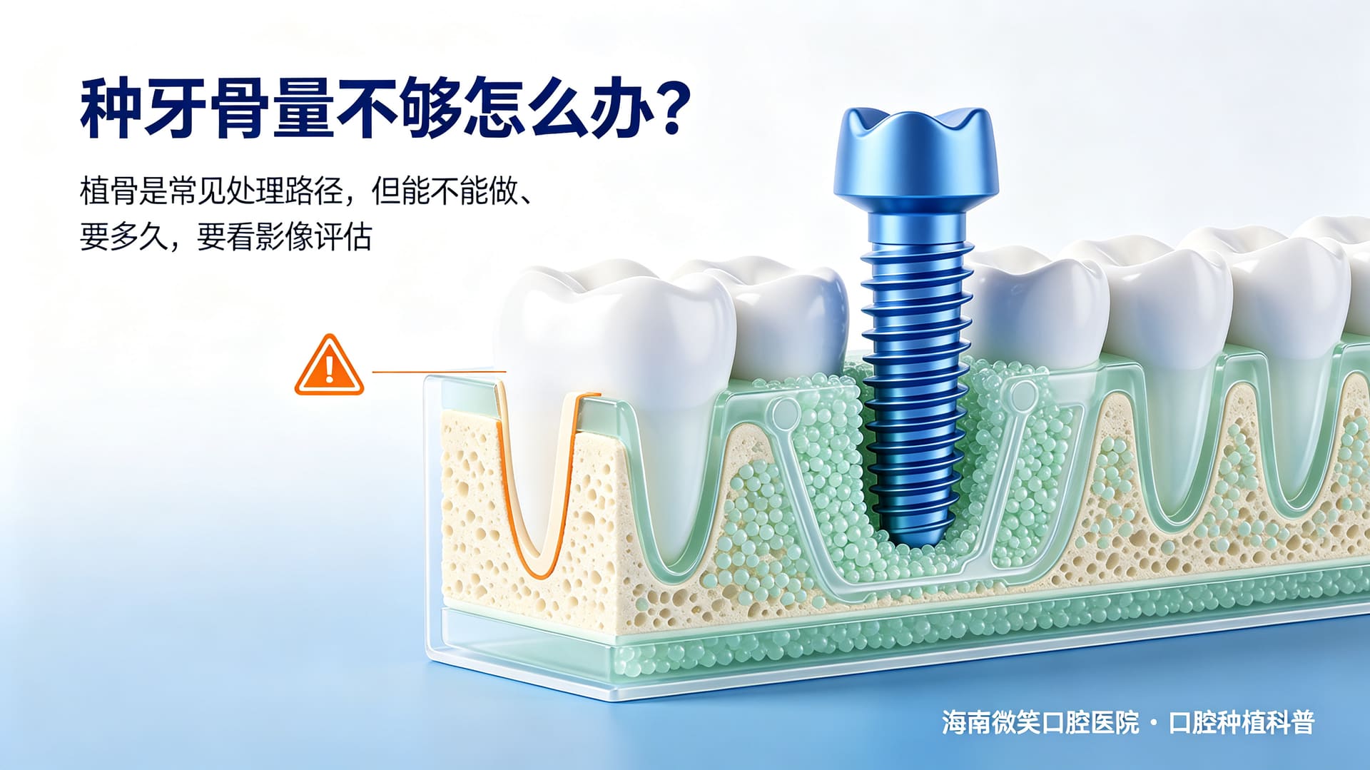 种牙骨量不够怎么办?植骨是什么、要多久——海南微笑口腔医院